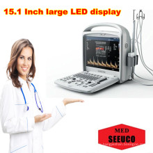 PT9600 Handheld Color Doppler Ultraschall Diagnosesystem